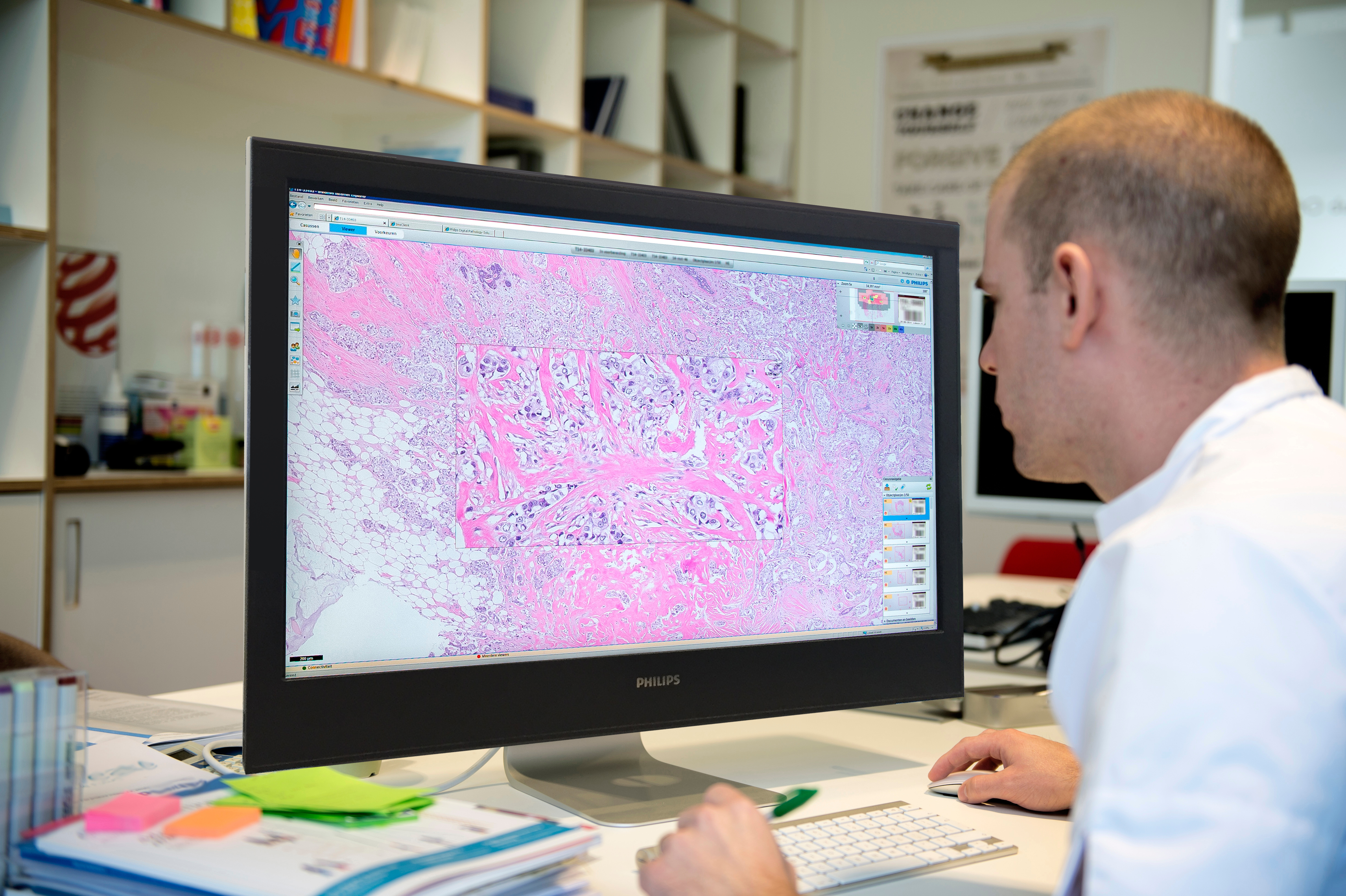 Philips Collaborates With Mgh Bwh To Advance Digital Pathology