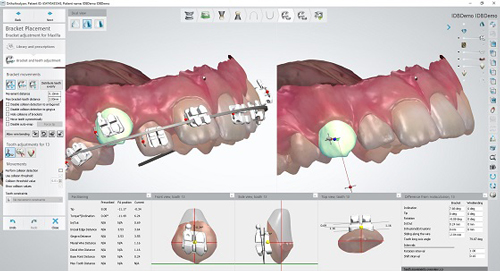 ortho extract software