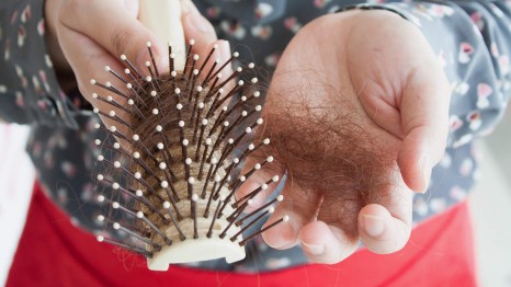 If You Think You've Been Losing More Hair Lately, This Is Probably Why