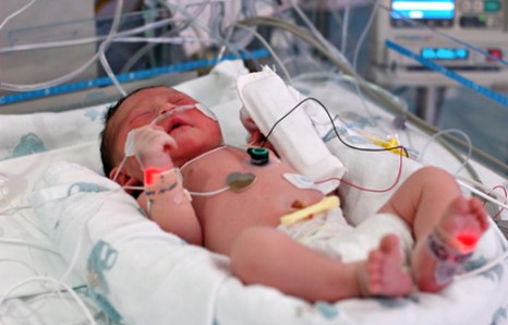 High-Flow Nasal Cannula Therapy Safe in Preterm Infants | RT