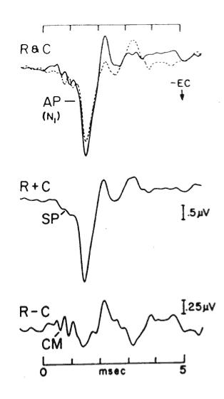 Developments in Electrocochleography: 2011 - Hearing Review