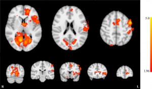Whole brain effects of neurofeedback training. 