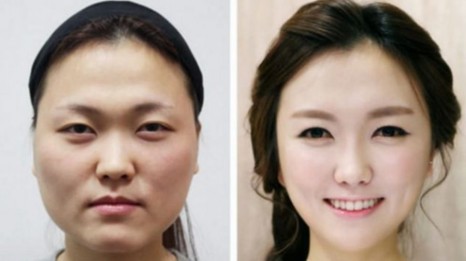 Chinese Women Now Spend More Money on Plastic Surgery Than Any Other ...