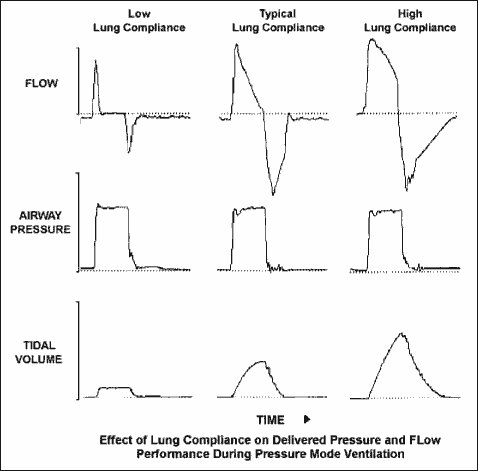 Pediatric Invasive Mechanical Ventilation - RT: For Decision Makers in ...