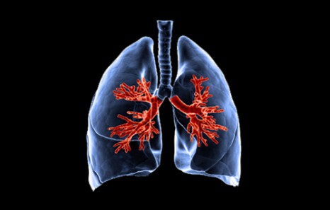 Lung Simulator to Treat Acute Respiratory Distress Syndrome